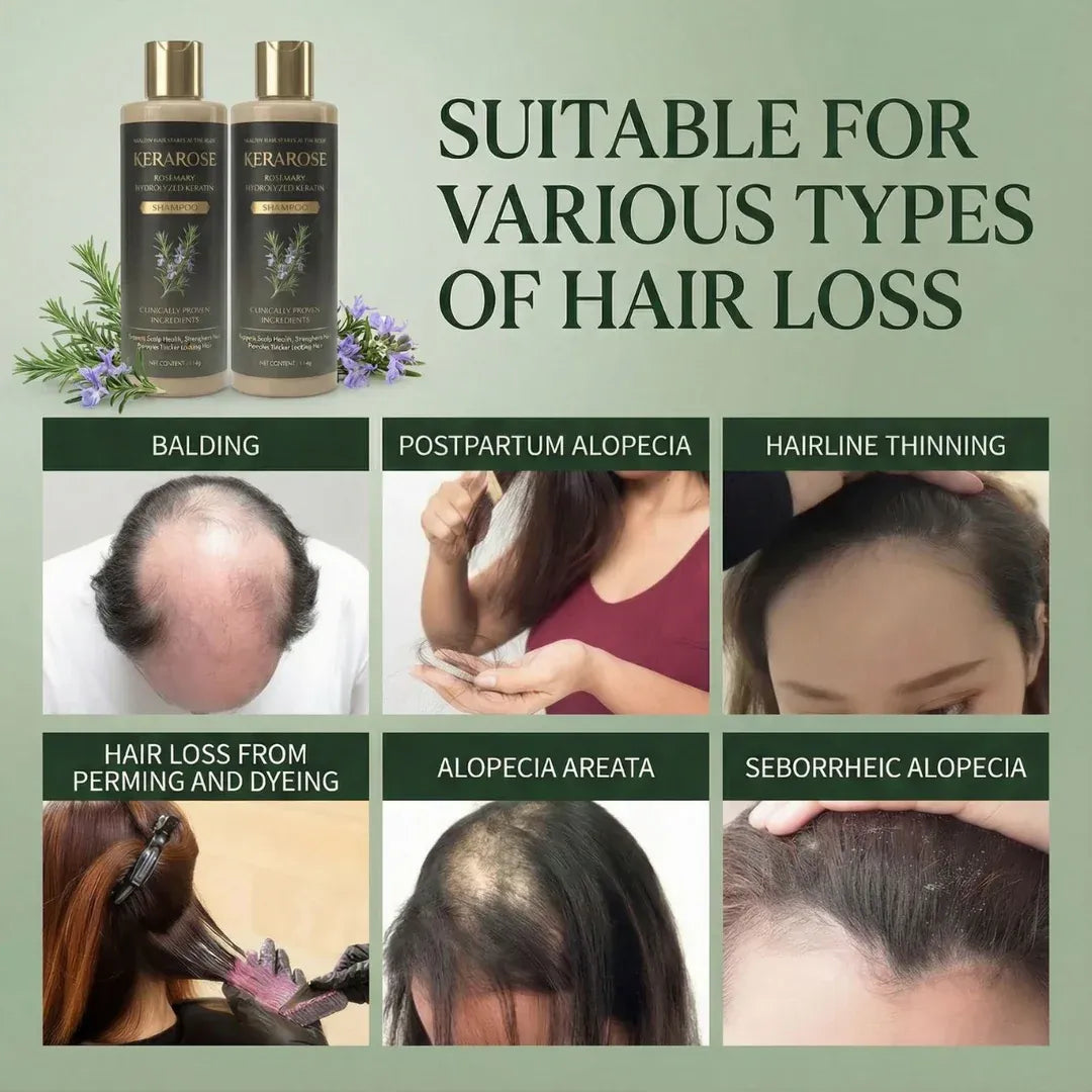 (BUY 1 GET 1 FREE) Kerarose - Magic Rosemary Hair Growth Shampoo